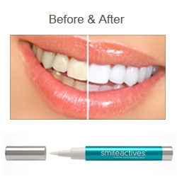 ハワイのおすすめコスメ店 ベルヴィー 人気商品や 10オフになるお得なクーポンも 便利なペンタイプのティースホワイトニング アロハストリート ハワイの予約 クーポン